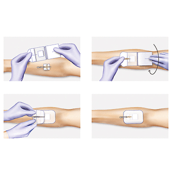 Hartmann Cosmopor® I.V. Kanülenfixierverband Anleitung