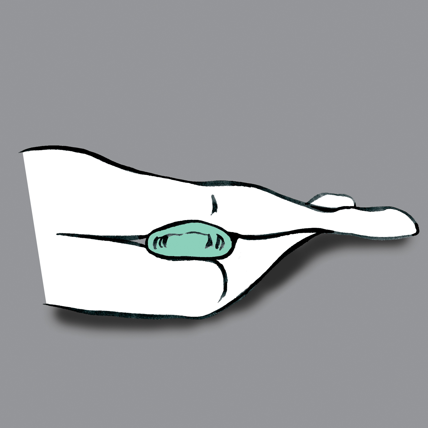Lück Rhombo-fill® Lagerungsring Position2